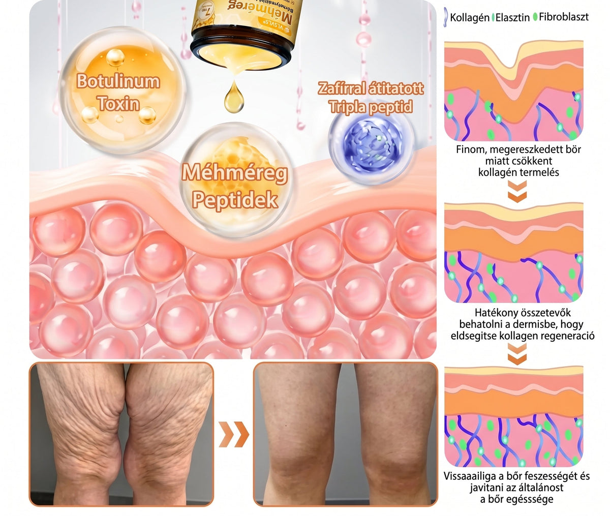 🔹 𝑽𝙇𝙎𝑽𝑳𝑺® Méhméreg Bőr Helyreállító Krém (👨‍⚕‍CE Tanúsítvány)👍✅