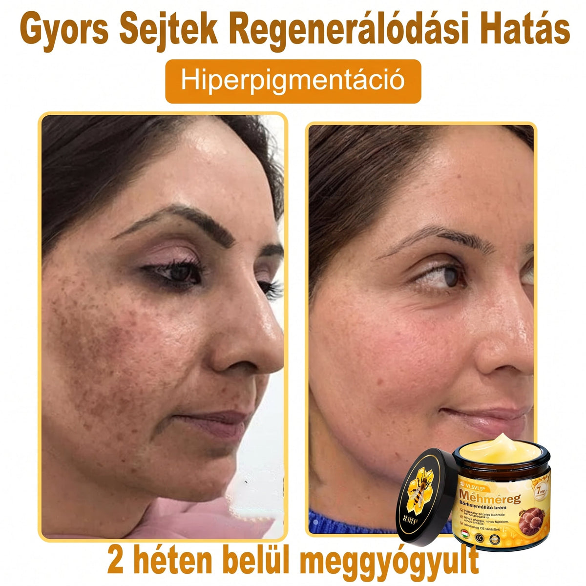 🔹 𝑽𝙇𝙎𝑽𝑳𝑺® Méhméreg Bőr Helyreállító Krém (👨‍⚕‍CE Tanúsítvány)👍✅