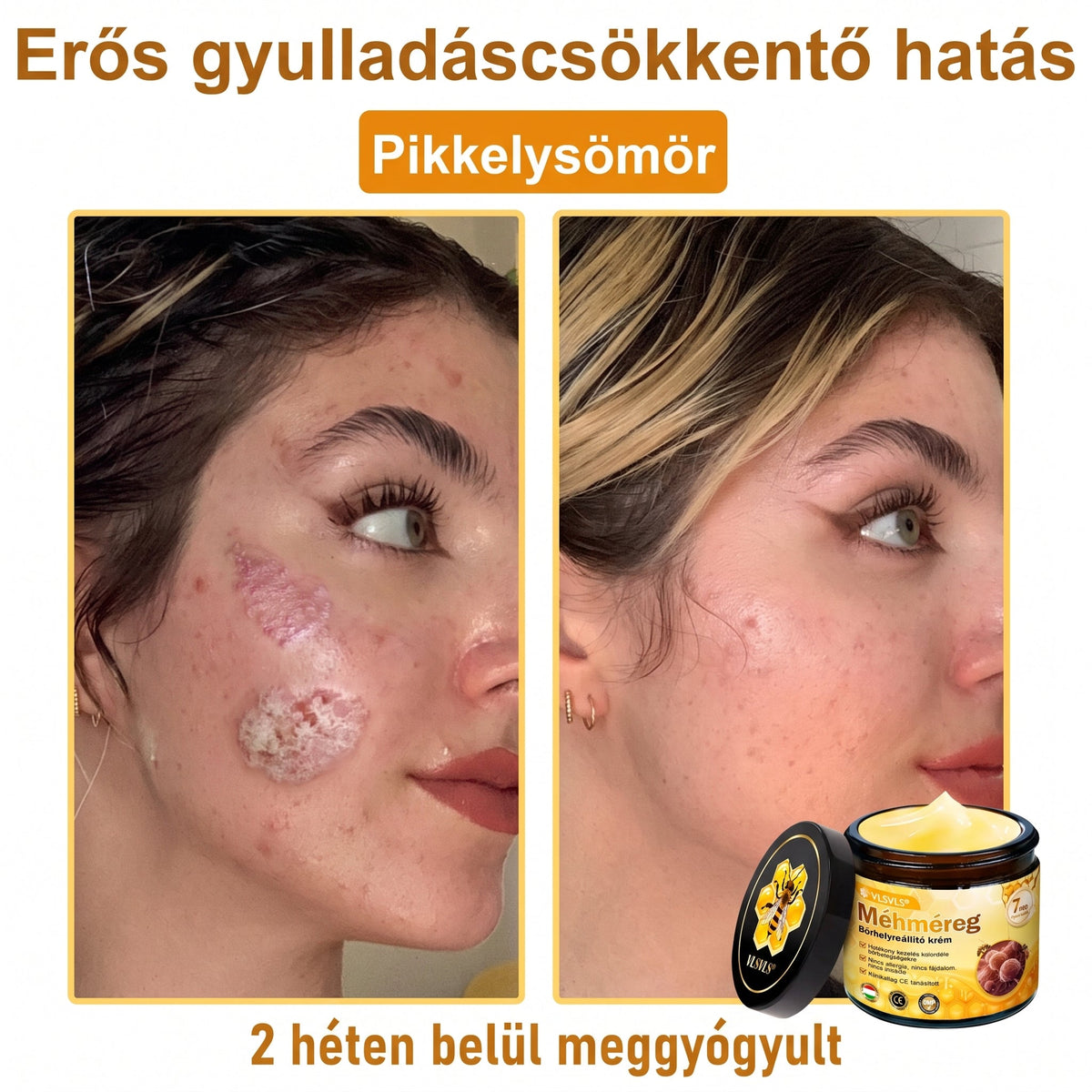 🔹 𝑽𝙇𝙎𝑽𝑳𝑺® Méhméreg Bőr Helyreállító Krém (👨‍⚕‍CE Tanúsítvány)👍✅