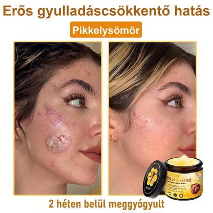 🔹 𝑽𝙇𝙎𝑽𝑳𝑺® Méhméreg Bőr Helyreállító Krém (👨‍⚕‍CE Tanúsítvány)👍✅