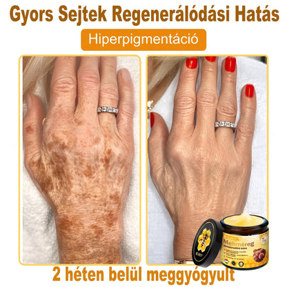 🔹 𝑽𝙇𝙎𝑽𝑳𝑺® Méhméreg Bőr Helyreállító Krém (👨‍⚕‍CE Tanúsítvány)👍✅