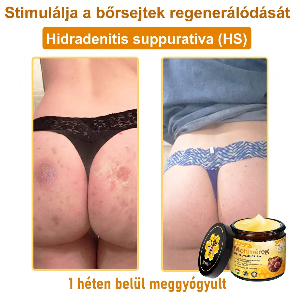 🔹 𝑽𝙇𝙎𝑽𝑳𝑺® Méhméreg Bőr Helyreállító Krém (👨‍⚕‍CE Tanúsítvány)👍✅