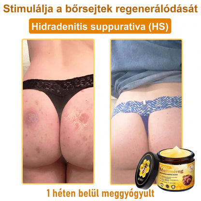 🔹 𝑽𝙇𝙎𝑽𝑳𝑺® Méhméreg Bőr Helyreállító Krém (👨‍⚕‍CE Tanúsítvány)👍✅