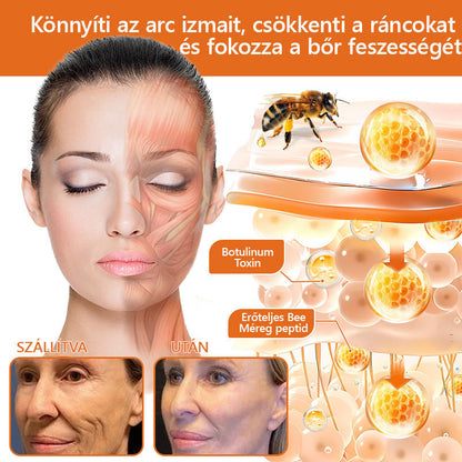 🔹 𝑽𝙇𝙎𝑽𝑳𝑺® Méhméreg Bőr Helyreállító Krém (👨‍⚕‍CE Tanúsítvány)👍✅