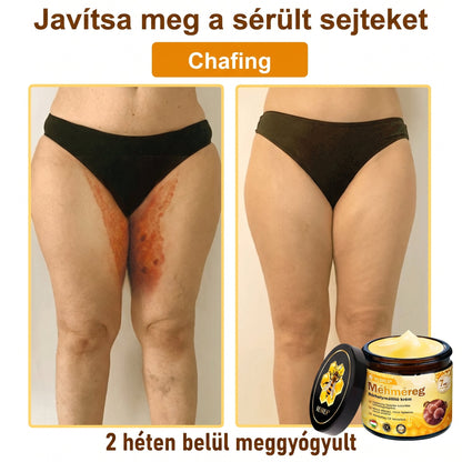 🔹 𝑽𝙇𝙎𝑽𝑳𝑺® Méhméreg Bőr Helyreállító Krém (👨‍⚕‍CE Tanúsítvány)👍✅