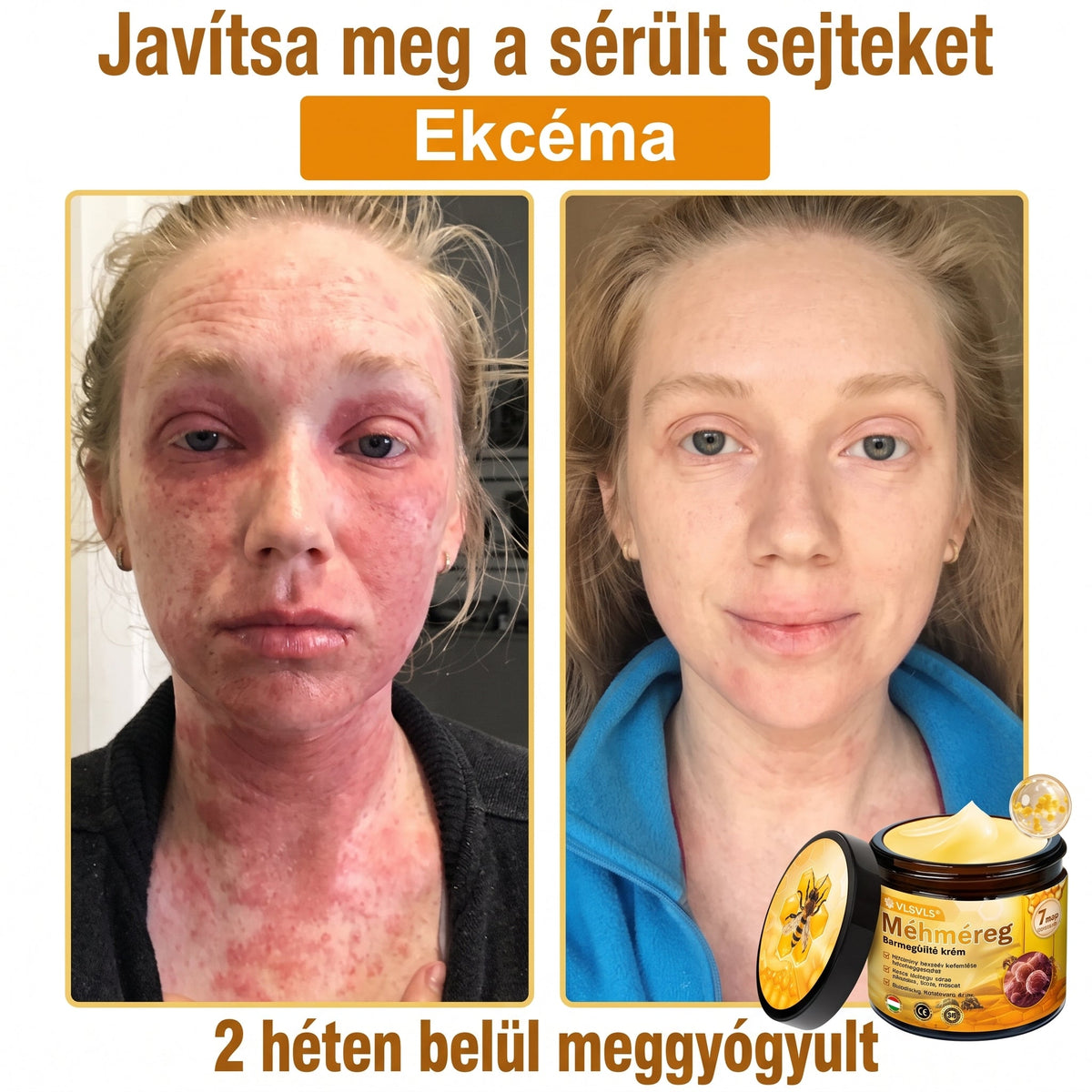 🔹 𝑽𝙇𝙎𝑽𝑳𝑺® Méhméreg Bőr Helyreállító Krém (👨‍⚕‍CE Tanúsítvány)👍✅