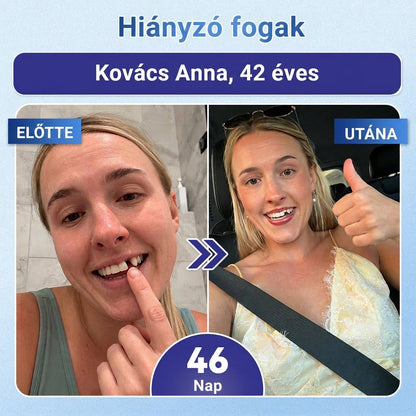 🇭🇺🦷 Mondj búcsút az érzékenységnek és kellemetlenségeknek! 𝐂𝐨𝐚𝐮𝐨𝐨® Tideglusib szájcsíkok – gyors regenerálás a fogaknak és az ínynek 😊